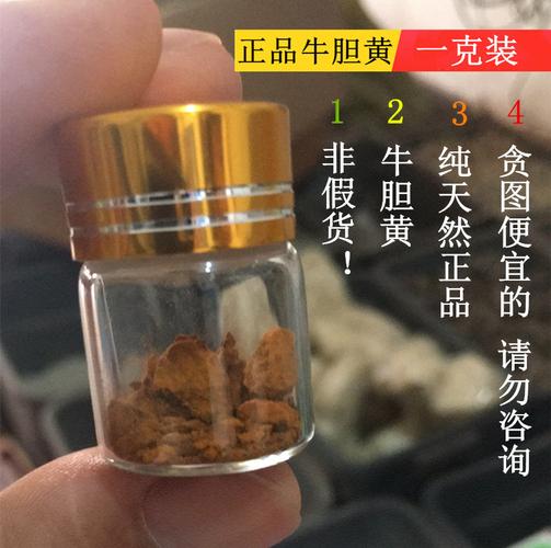 牛胆结石叫什么中药